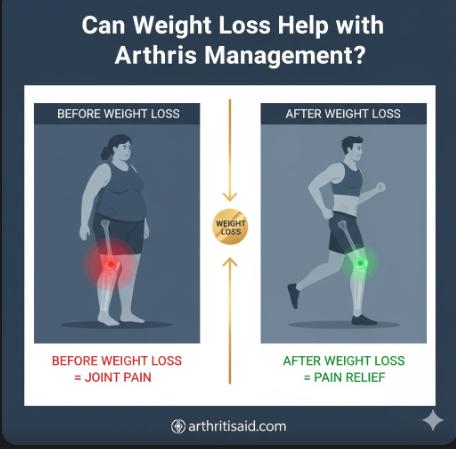 Can Weight Loss Help with Arthritis Management
